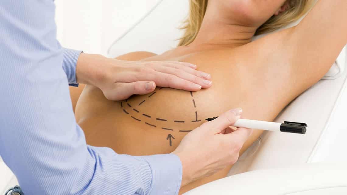 Augmentation mammaire par prothèses :  Tout ce qu’il faut savoir