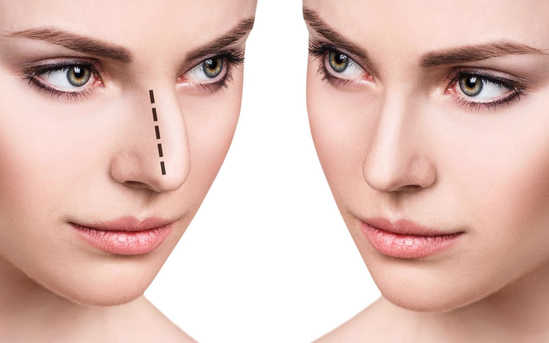 Quelle destination pour une rhinoplastie réussie et à petit prix ?